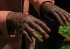 NYAMIRA MOTHER BATTLING RARE SKIN DISEASE SEEKS HELP FOR TREATMENT AND CHILDREN’S SCHOOL FEES